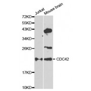 Western blot analysis of extracts of various cell lines, using CDC42 antibody (abx001102) at 1/1000 dilution.