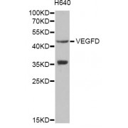 Western blot analysis of extracts of H640 cells, using VEGFD antibody (abx001107) at 1/1000 dilution.