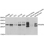 Western blot analysis of extracts of various cell lines, using PDGFB antibody (abx001108) at 1/1000 dilution.