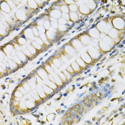Platelet Derived Growth Factor Subunit B (PDGFB) Antibody