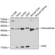 Western blot analysis of extracts of A-549 (Lane 1), HeLa (Lane 2), Jurkat (Lane 3), 293T (Lane 4) cells, Mouse liver (Lane 5) and kidney (Lane 6) tissues (25 µg per lane), using Fragile Histidine Triad Antibody (1/1000 dilution), followed by <a href="https://www.abbexa.com/index.php?route=product/search&search=abx005548" target="_blank">abx005548</a> - HRP-conjugated Goat Anti-Rabbit IgG, H+L antibody (1/10000 dilution) and 3% non-fat dry milk in TBST for blocking.