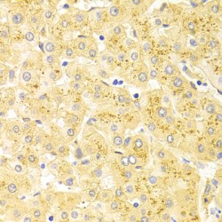 Wilms Tumor 1 (WT1) Antibody