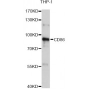 Western blot analysis of extracts of THP-1 cells, using CD86 Antibody (abx001112) at 1/1000 dilution.