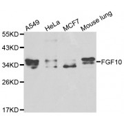 Western blot analysis of extracts of various cell lines, using FGF10 antibody (abx001113) at 1/1000 dilution.