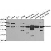 Western blot analysis of extracts of various cell lines, using MMP3 antibody (abx001114) at 1/1000 dilution.
