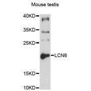 Western blot analysis of extracts of mouse testis, using LCN6 antibody (abx001116) at 1/1000 dilution.