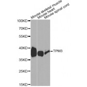 Western blot analysis of extracts of various cell lines, using TPM3 antibody (abx001118) at 1/1000 dilution.