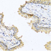 Immunohistochemistry of paraffin-embedded human prostate using DEFB121 antibody (abx001120) at dilution of 1/100 (40x lens).