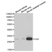 Western blot analysis of extracts of various cell lines, using CA3 antibody (abx001124) at 1/1000 dilution.
