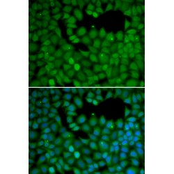 Neuroepithelial Cell Transforming Gene 1 (NET1) Antibody