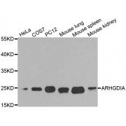 Western blot analysis of extracts of various cell lines, using ARHGDIA antibody (abx001126) at 1/1000 dilution.