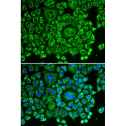 Rho GDP-Dissociation Inhibitor 1 (ARHGDIA) Antibody