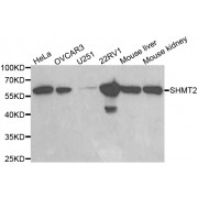 Western blot analysis of extracts of various cell lines, using SHMT2 antibody (abx001127) at 1/1000 dilution.