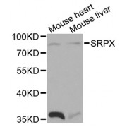 Western blot analysis of extracts of various cell lines, using SRPX antibody (abx001129) at 1/1000 dilution.