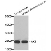 Western blot analysis of extracts of various cell lines, using AK1 antibody (abx001130) at 1/1000 dilution.