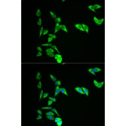 Adenylate Kinase 1 (AK1) Antibody