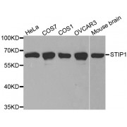 Western blot analysis of extracts of various cell lines, using STIP1 antibody (abx001131) at 1/1000 dilution.
