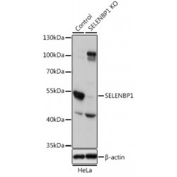 Selenium-Binding Protein 1 (SELENBP1) Antibody