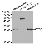 Western blot analysis of extracts of various cell lines, using CST8 antibody (abx001136) at 1/1000 dilution.