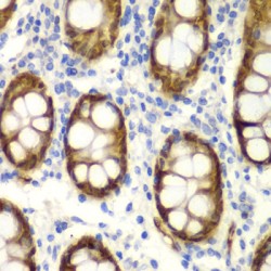 GIPC PDZ Domain Containing Family, Member 2 (GIPC2) Antibody