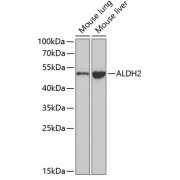 Western blot analysis of extracts of various cell lines, using ALDH2 antibody (abx001138) at 1/1000 dilution.