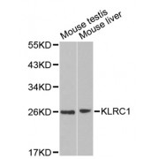 Western blot analysis of extracts of various cell lines, using KLRC1 antibody (abx001145) at 1/1000 dilution.