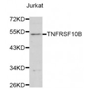 Western blot analysis of extracts of Jurkat cells, using TNFRSF10B antibody (abx001148) at 1/1000 dilution.