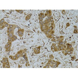Tumor Necrosis Factor Ligand Superfamily Member 13 / CD256 (TNFSF13) Antibody