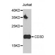 Western blot analysis of extracts of Jurkat cells, using CD3D antibody (abx001150) at 1/500 dilution.