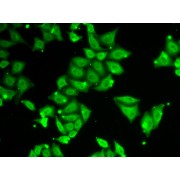 Immunofluorescence analysis of HeLa cells using ATXN3 antibody (abx001155).