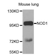 Western blot analysis of extracts of mouse lung, using NOD1 antibody (abx001158) at 1/1000 dilution.