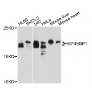 Western blot analysis of extracts of various cell lines, using EIF4EBP1 antibody (abx001160) at 1/1000 dilution.