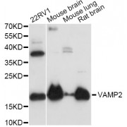Western blot analysis of extracts of various cell lines, using VAMP2 antibody (abx001161) at 1:3000 dilution.