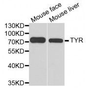 Western blot analysis of extracts of various cell lines, using TYR antibody (abx001163) at 1/1000 dilution.