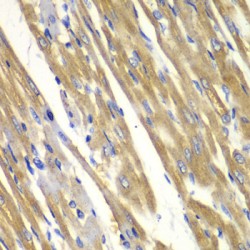 Tyrosinase (TYR) Antibody