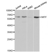 Western blot analysis of extracts of various cell lines, using MITF antibody (abx001164) at 1/1000 dilution.
