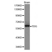 Western blot analysis of extracts of mouse brain, using TDG antibody (abx001168).