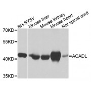 Western blot analysis of extracts of various cell lines, using ACADL antibody (abx001172) at 1/1000 dilution.
