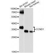 Western blot analysis of extracts of various cell lines, using CCND1 antibody (abx001183) at 1/500 dilution.