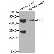 Western blot analysis of extracts of various cell lines, using HFE antibody (abx001186) at 1/1000 dilution.