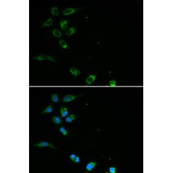 Hereditary Hemochromatosis Protein (HFE) Antibody