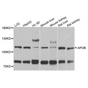 Western blot analysis of extracts of various cell lines, using APOB antibody (abx001189) at 1/1000 dilution.