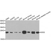 Western blot analysis of extracts of various cell lines, using SOD2 antibody (abx001193) at 1/1000 dilution.