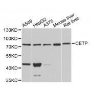 Western blot analysis of extracts of various cell lines, using CETP antibody (abx001200) at 1/1000 dilution.