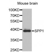 Western blot analysis of extracts of mouse brain, using SPP1 antibody (abx001202) at 1/1000 dilution.