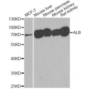 Western blot analysis of extracts of various cell lines, using ALB antibody (abx001204) at 1/500 dilution.