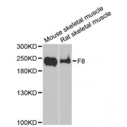 Western blot analysis of extracts of various cell lines, using F8 antibody (abx001205) at 1/1000 dilution.