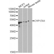 Western blot analysis of extracts of various cell lines, using CYP17A1 Antibody (abx001208) at 1/1000 dilution.