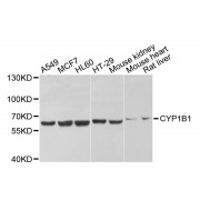 Western blot analysis of extracts of various cell lines, using CYP1B1 antibody (abx001210) at 1/1000 dilution.
