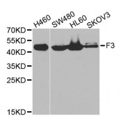 Western blot analysis of extracts of various cell lines, using F3 antibody (abx001211) at 1/1000 dilution.